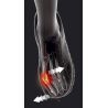 Epitact - Hallux Valgus Flex 02