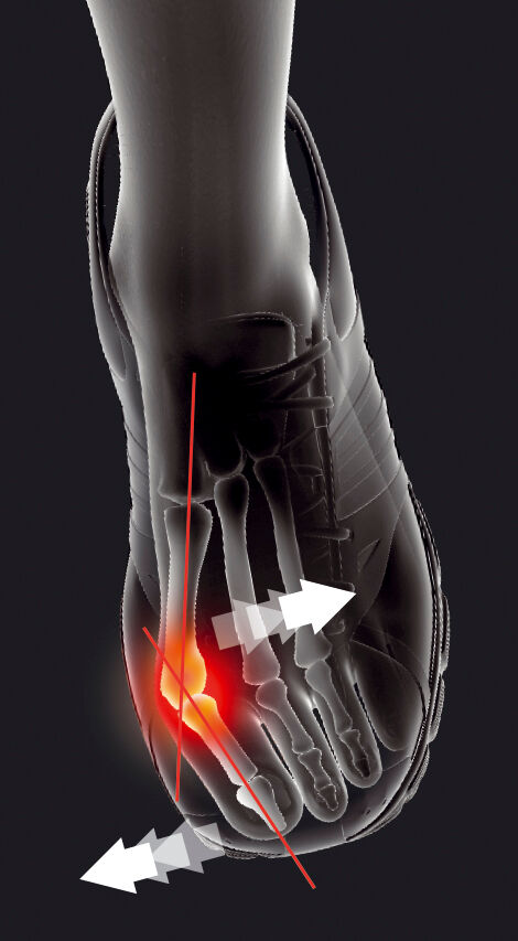 Epitact - Hallux Valgus Flex 02